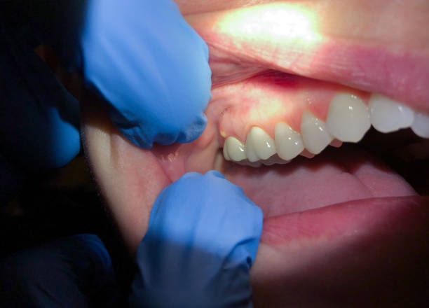 Best Emergency Gum Pain Relief  in Vestavia Hills, AL